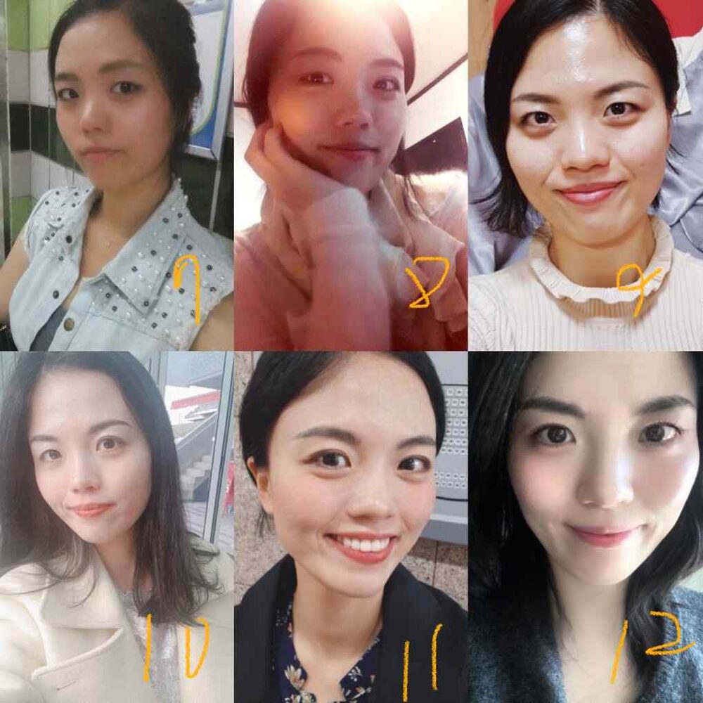 류다감 얼굴 변화 기록 7-12