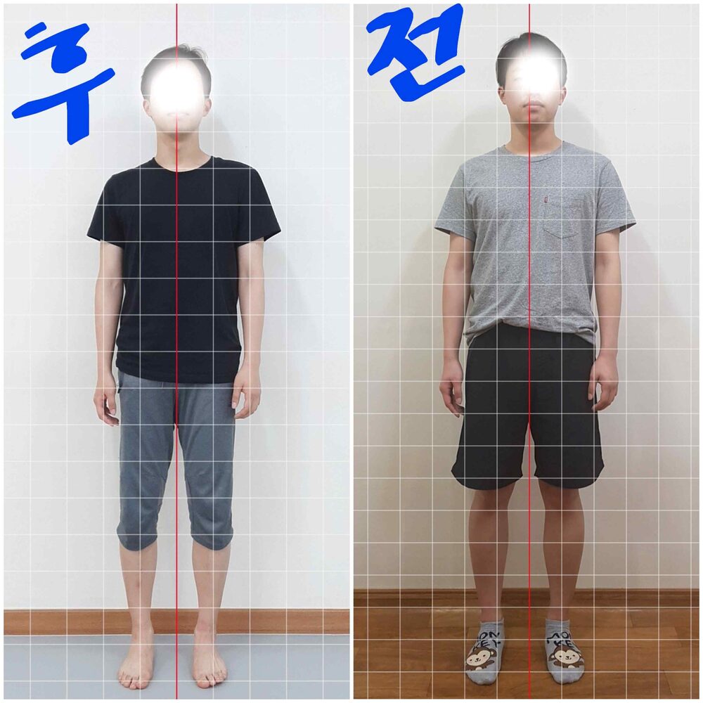 운동 중 고관절 부상, 한 달 만의 회복