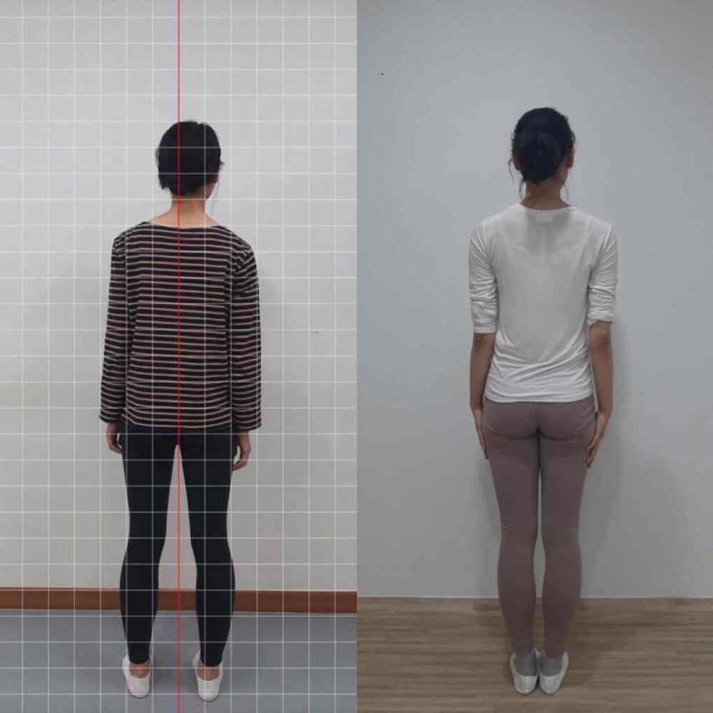 턱관절 통증과 온몸의 미세떨림 — 직장을 관둘 만큼 허약했던 몸의 회복 — 전신 전후(뒤)