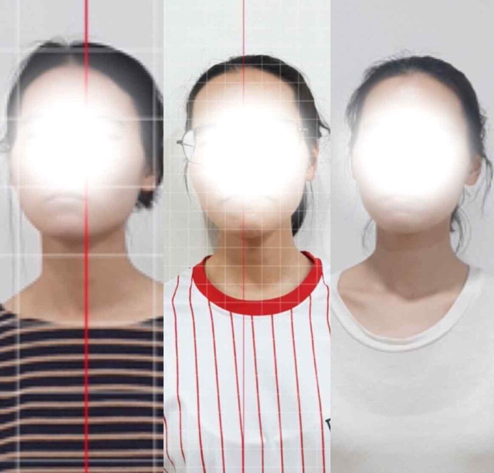 턱관절 통증과 온몸의 미세떨림 — 직장을 관둘 만큼 허약했던 몸의 회복